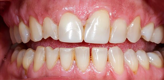 Anca Dent - Clinica Stomatologica, Bucuresti