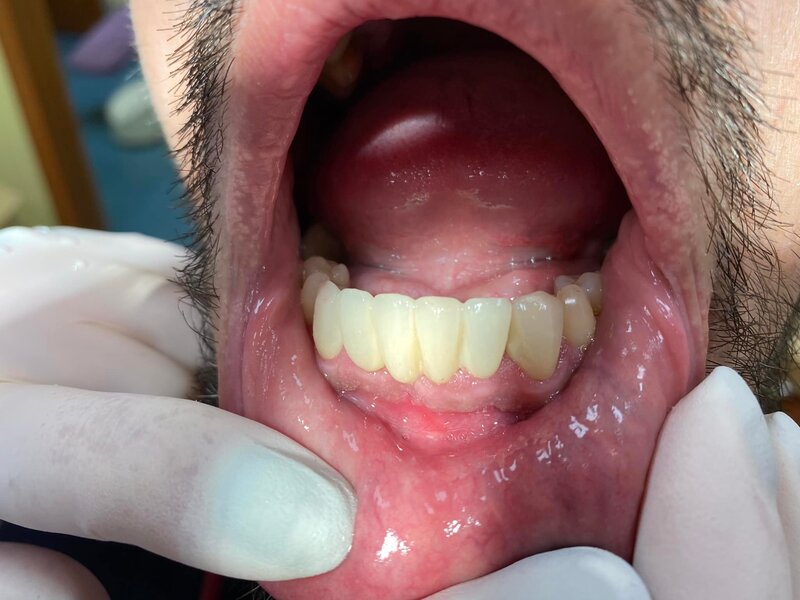 Anca Dent - Clinica Stomatologica, Bucuresti