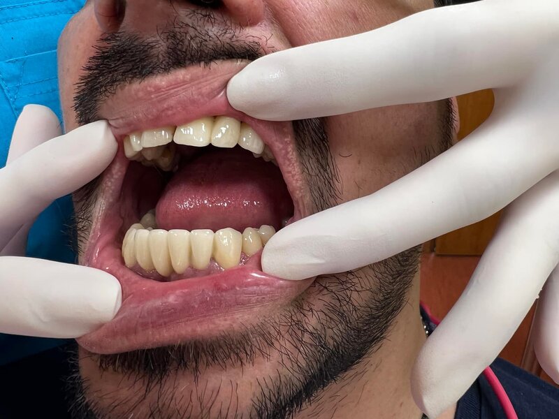 Anca Dent - Clinica Stomatologica, Bucuresti