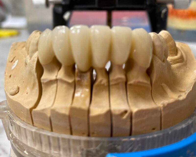 Anca Dent - Clinica Stomatologica, Bucuresti