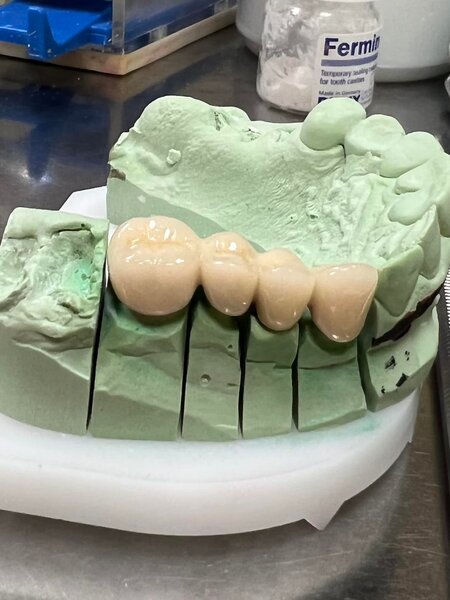 Anca Dent - Clinica Stomatologica, Bucuresti