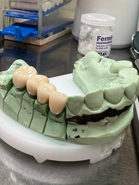 Anca Dent - Clinica Stomatologica, Bucuresti