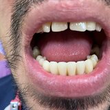 Anca Dent - Clinica Stomatologica, Bucuresti